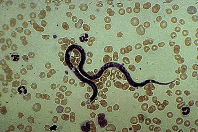 parasite sous-cutané Filaria