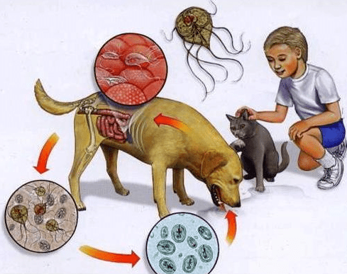 Symptômes d'une infection de Lamblia