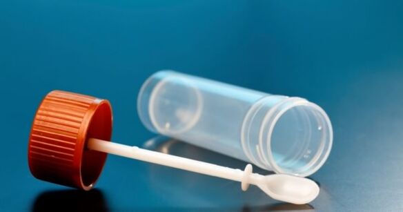 Tests parasites