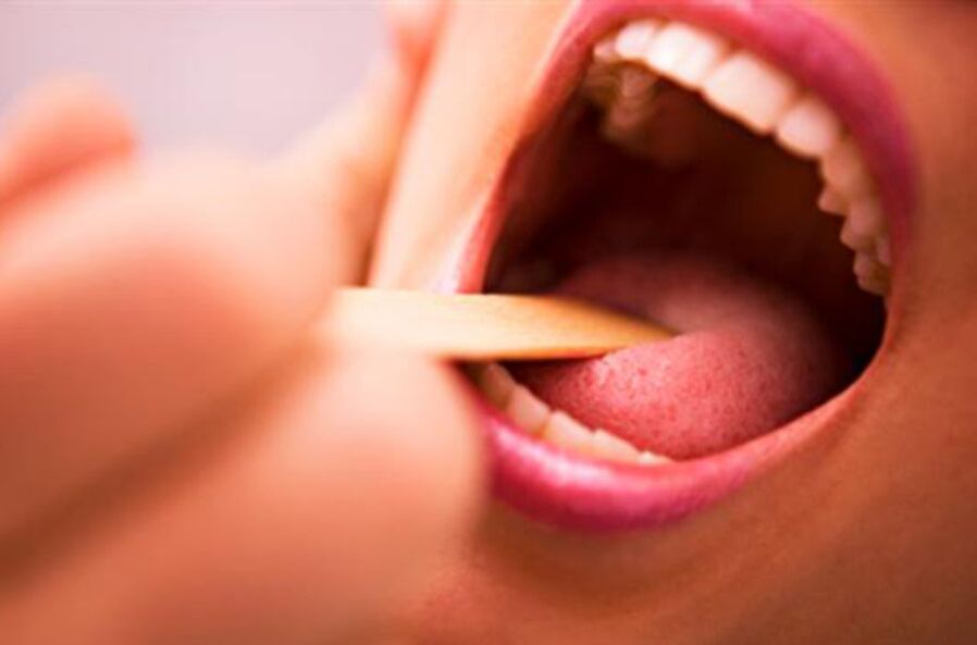 Types de parasites dans la bouche humaine